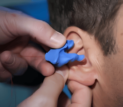 Ear_Impression_blue_CPE